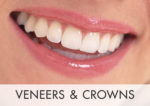 Veneers & Crowns.jpg