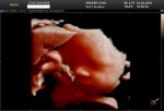 3D 4D Ultrasound.jpg