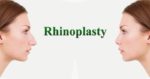 rhinoplasty-nyc1.jpg